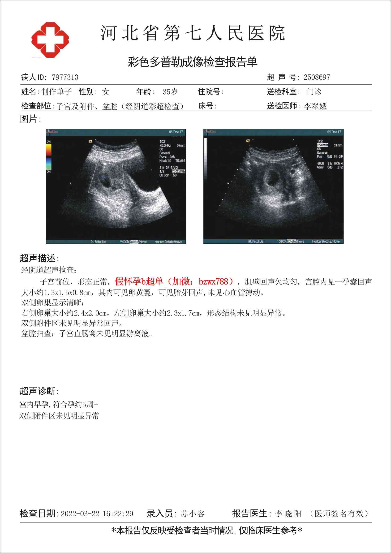 在线怀孕报告单生成器：一键制作图片报告、抖音证明，轻松生成超单报告单