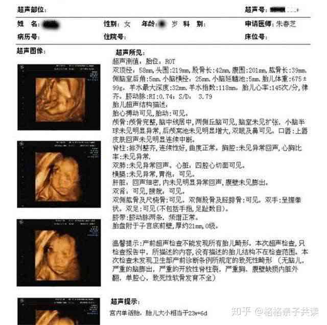 全面解读宝宝四维彩超结果：常见问题与应对策略分享