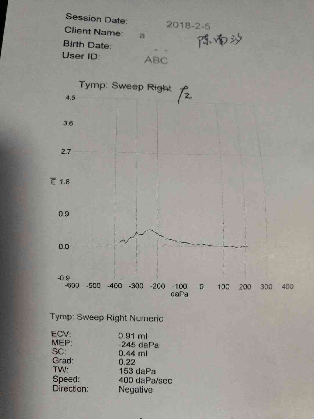 听力检测报告单怎么看数值AC与BC，例如AC47.5.BC43.8