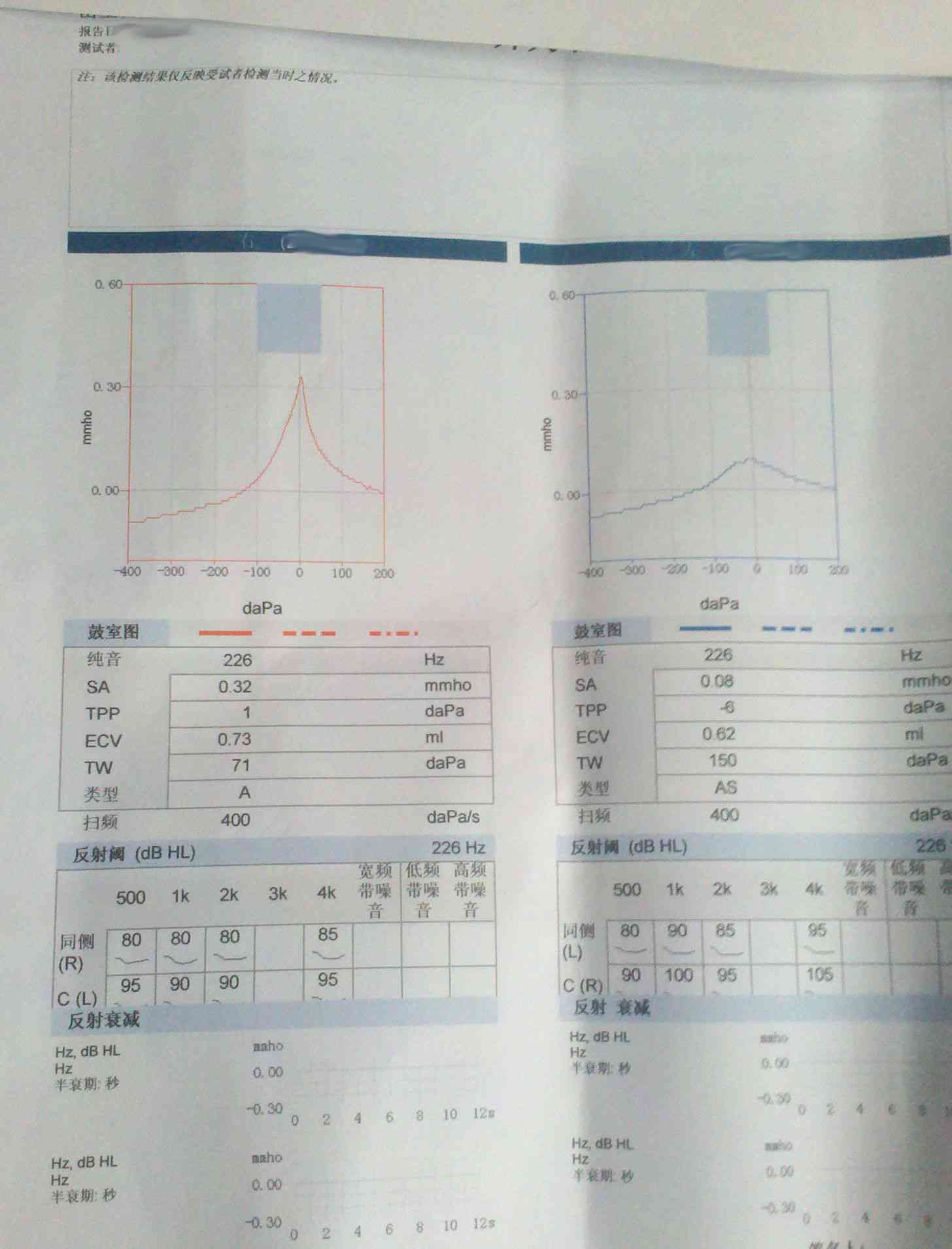 听力检测报告单怎么看数值AC与BC，例如AC47.5.BC43.8