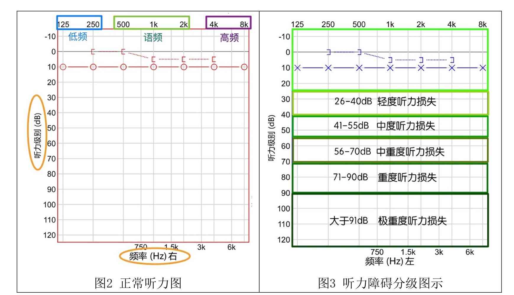 听力检测报告AI