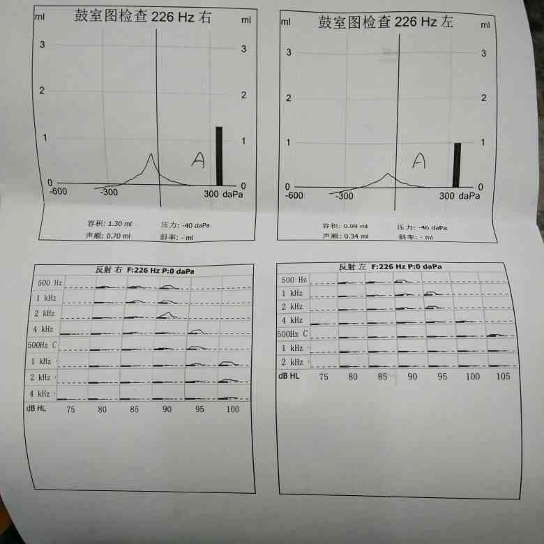 听力检测报告AI