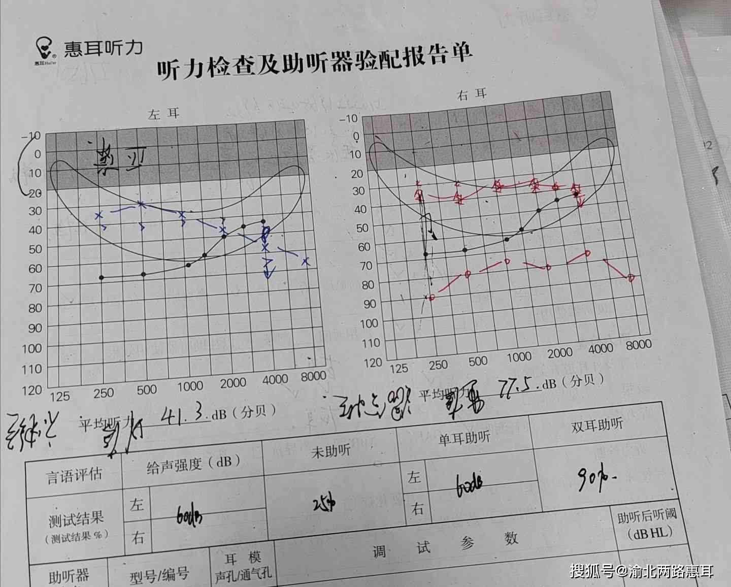 听力检测报告AI