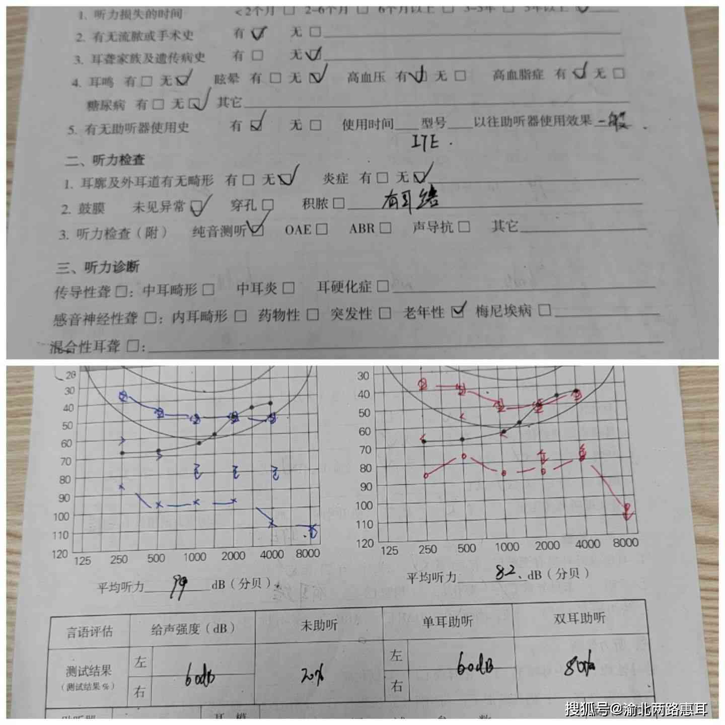 听力检测报告AI