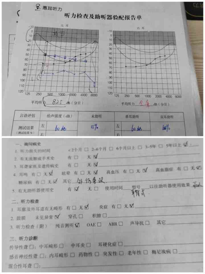 听力报告解读：如何详尽解读听力测试报告单