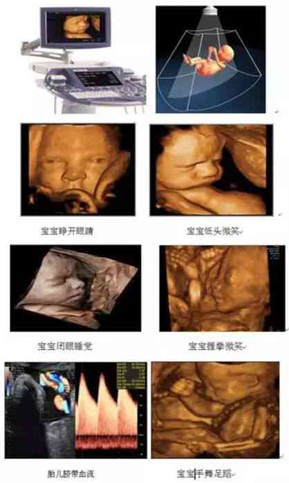 四维彩超AI技术成像文案：深度解析与优化建议