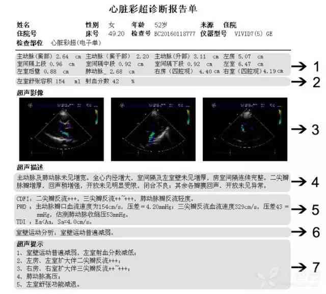 纯音测听报告单：如何正确解读结果及判定正常值