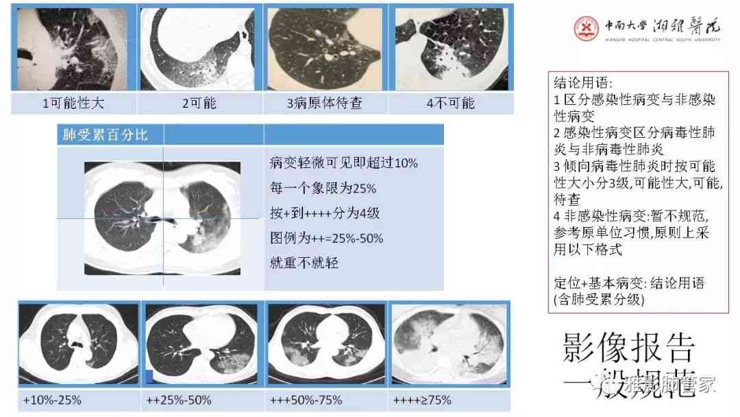 文库教程：如何按照模板书写正常与诊断CT报告