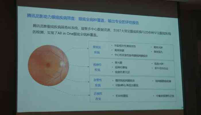 AI智能眼底报告：生成与解读、检测筛查及辅助诊断软件全解析