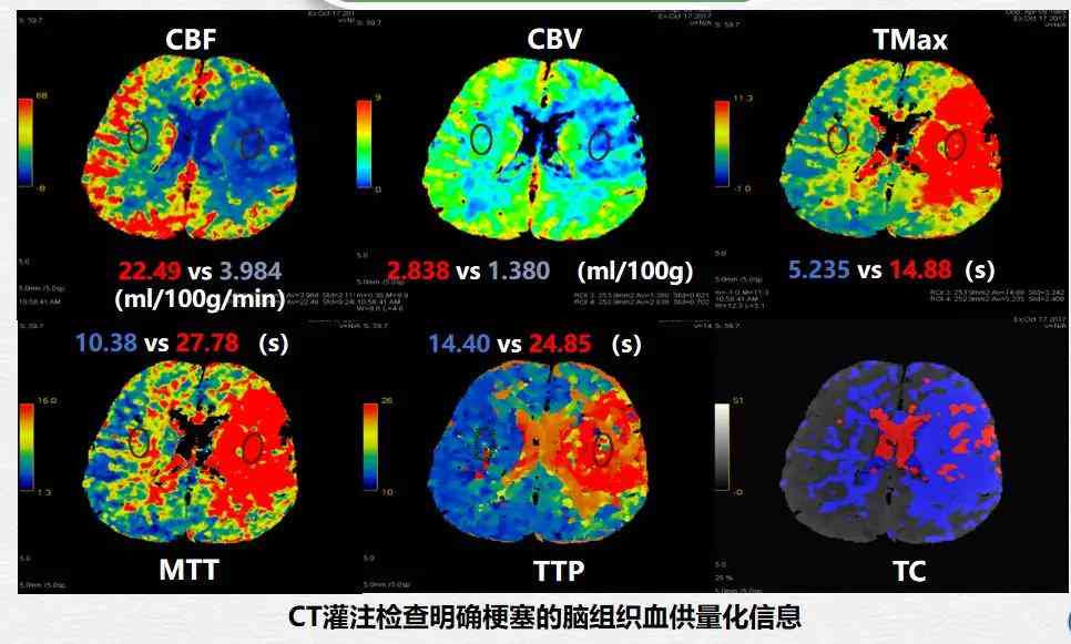 全面解读CT检查报告中的IM成像结果及常见相关问题解答