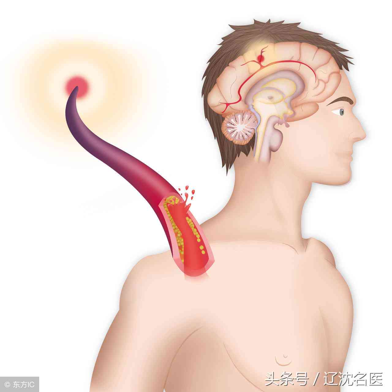 cta检查对身体危害、费用、时间及结果产出详解