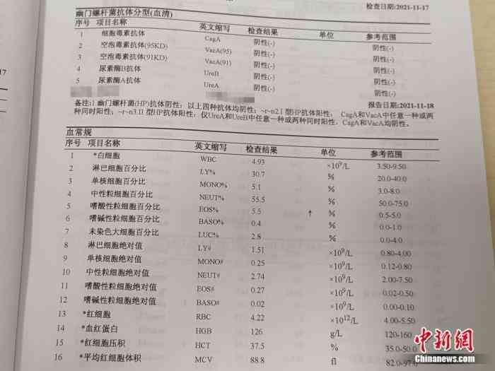 cta检查对身体危害、费用、时间及结果产出详解