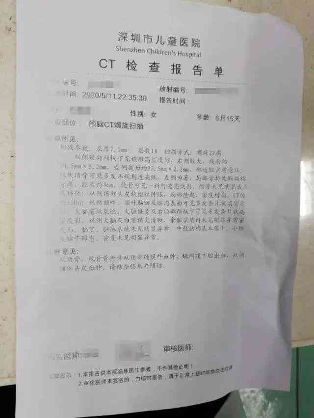 ct检查报告ai是什么意思