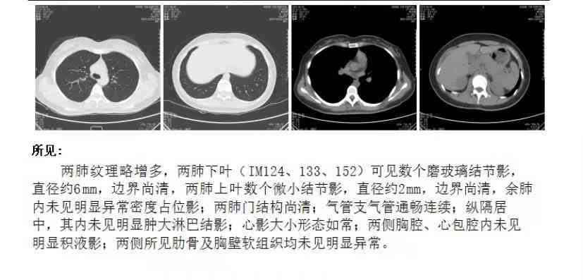 解读医院检查报告：一键查询与智能解读报告单软件