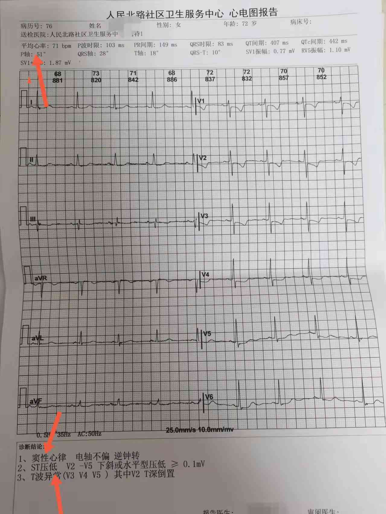 解读医院检查报告：一键查询与智能解读报告单软件