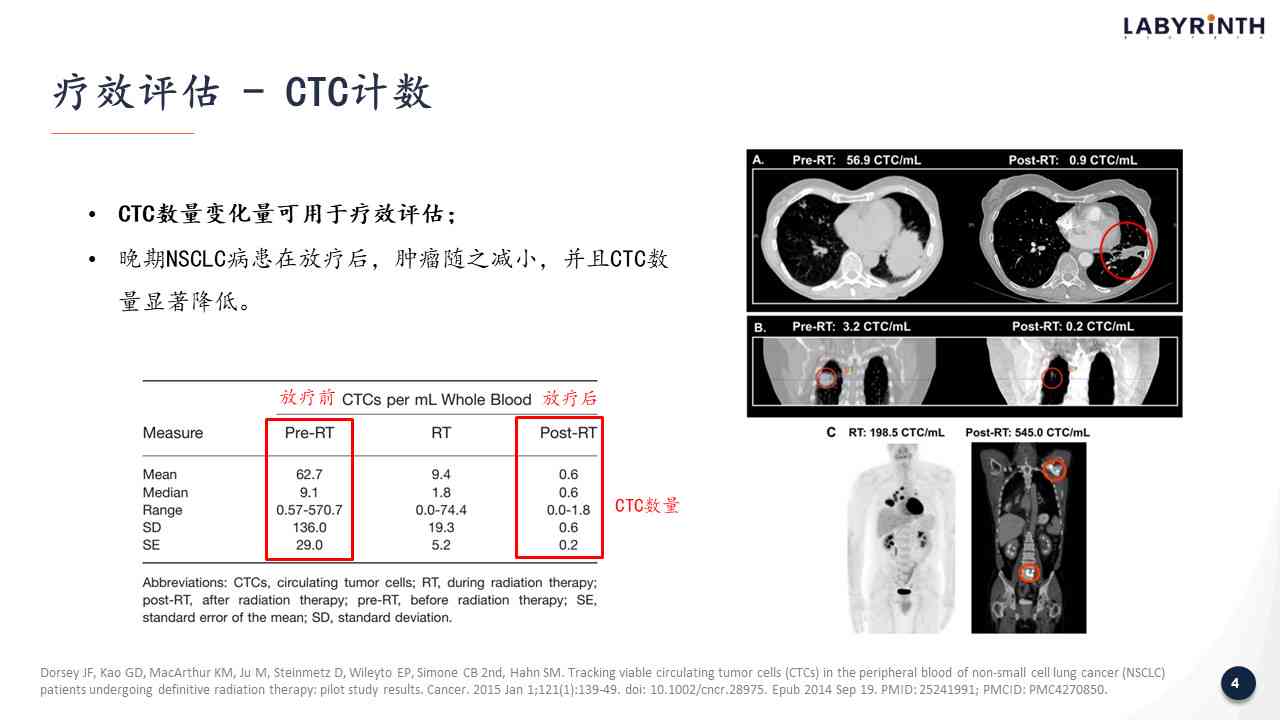 全面解读CT报告：探究iac含义及其潜在健意义