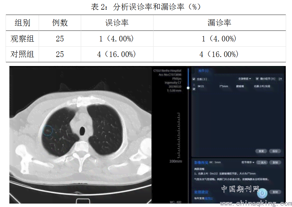 ai看ct报告：在线查询与解读CT报告单及AIS评估