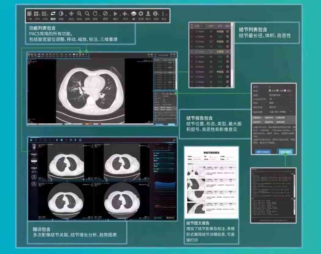 ai看ct报告：在线查询与解读CT报告单及AIS评估