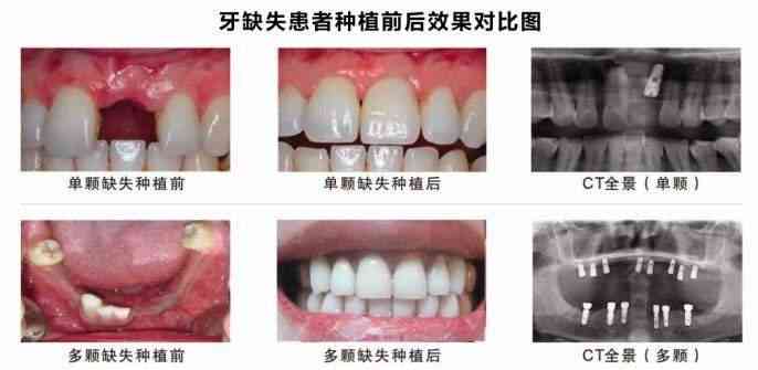 e看牙ai智能口腔报告