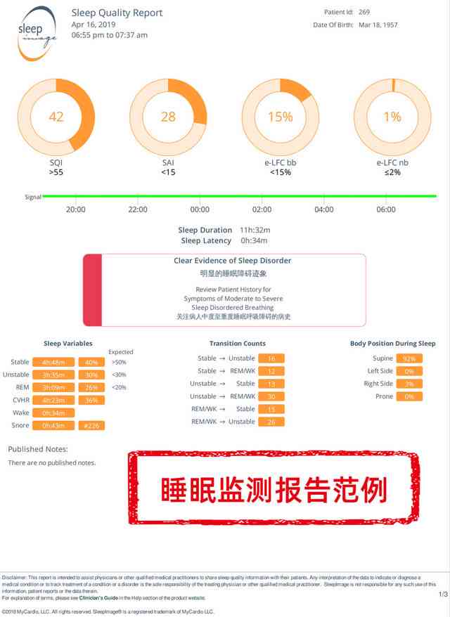 深度解析：AI睡眠报告如何提升您的睡眠质量与健管理