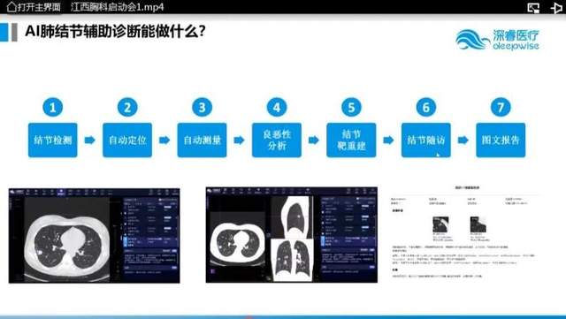 AI赋能医学影像诊断：提升精准性与效率，助力疾病早期发现与治疗