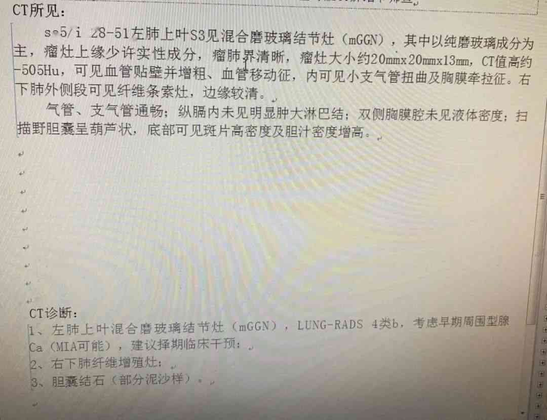 全球创新：AI智能解读CT报告，提升医疗影像诊断效率与准确性