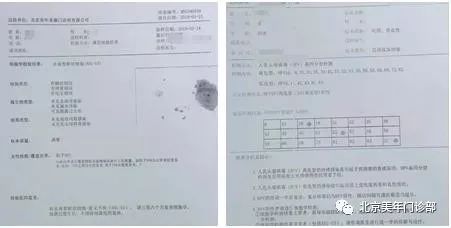 精准度解析：美年大健体检报告准确性探究