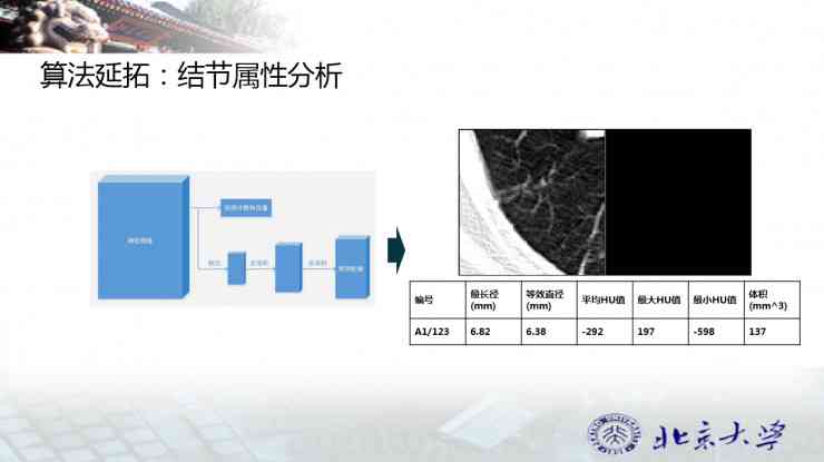 医生AI写报告影像怎么写：撰写医学影像报告单模板教程