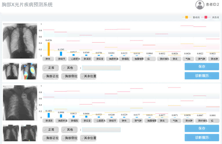 AI医生智能生成影像诊断报告，助力精准医疗决策