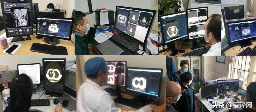 智能医学影像诊断报告一键生成系统