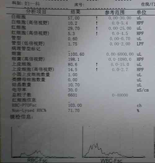 ai检验报告单解读