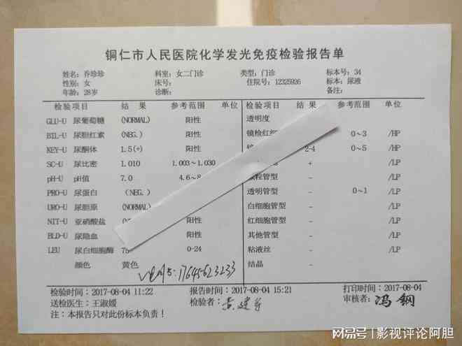 ai验血报告单解读是什么：详解单中Alpha含义及如何查看滋病指标