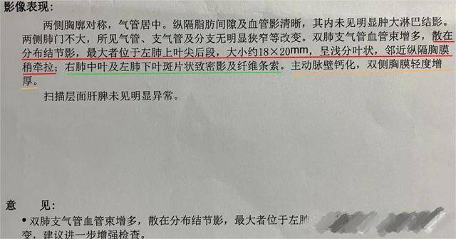 如何全面解读CT报告单：关键结果解读与注意事项指南