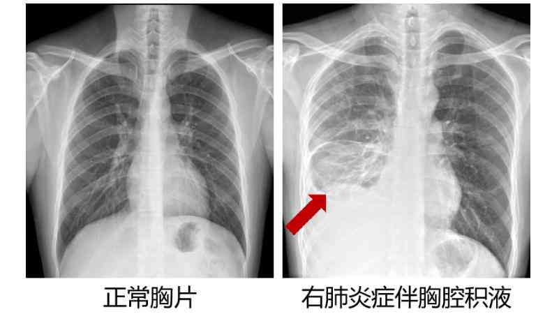 ct结果和报告有什么区别以及在医学诊断中的应用与重要性