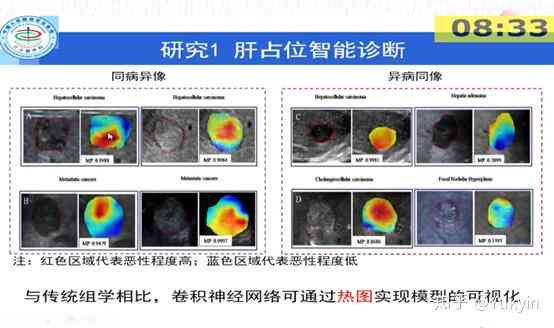 肝脏AI智能诊断技术全景分析及临床应用综述报告