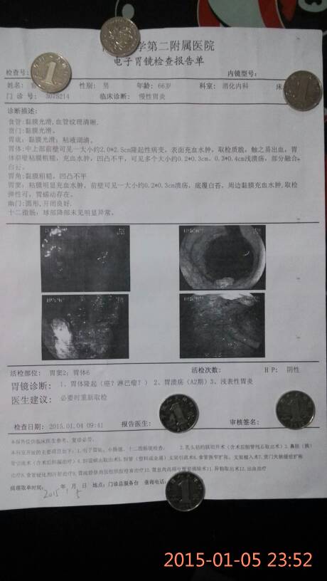 胃溃疡AI期报告：诊断结果与检测报告单