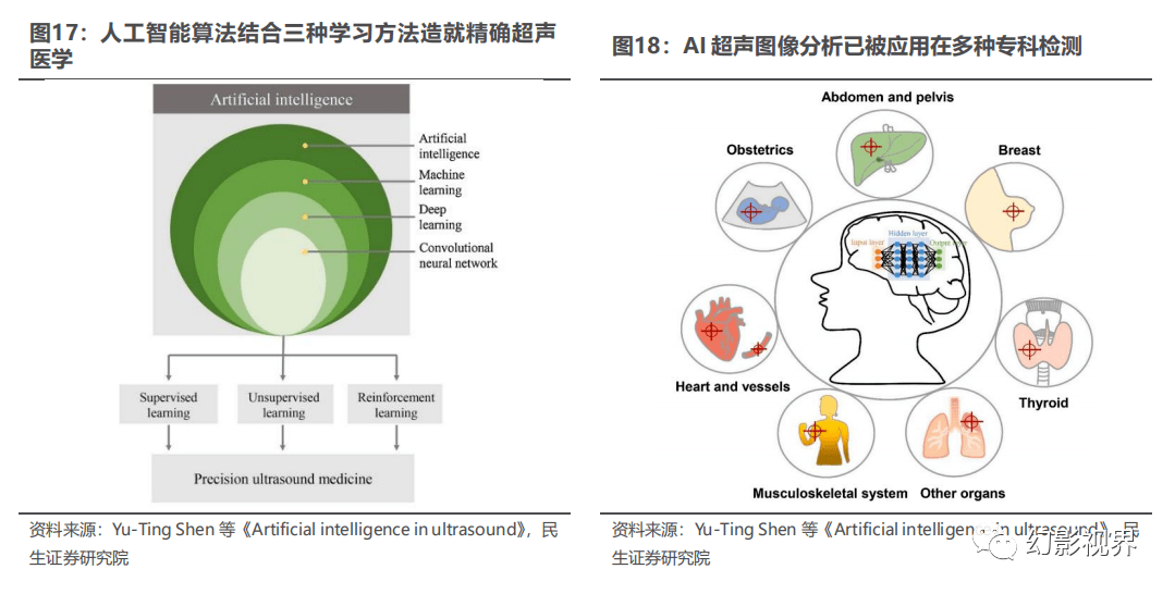 AI智能解读超声报告指南：全面解析与常见问题解答