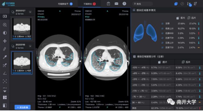 ai识别出超声报告的软件名称及常用软件列表