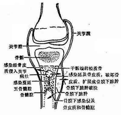 aif蛋白：探索其在细胞死亡、神经退行性疾病及治疗中的应用前景