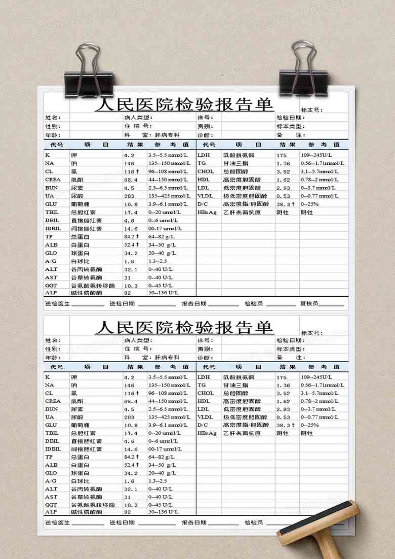 出货检验报告AQL：含义、填写方法及模板表格