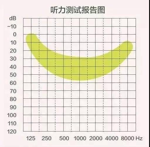 深度解读：电测听报告中的AI值含义及在听力评估中的应用