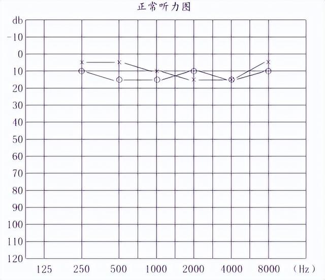 听力报告中AC和BC的含义及正常范围解析：全面了解气导与骨导听力的评估标准