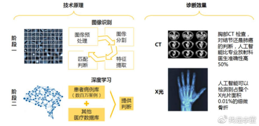 智能AI影像识别技术在医疗诊断中的应用与发展