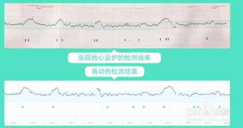 智能胎心监护仪AI报告解析：深度解读胎儿健状况