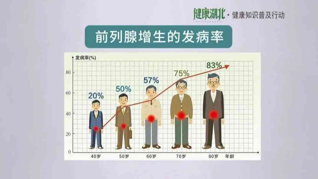 前列腺健全方位指南：常见问题解答与实用传口号集锦