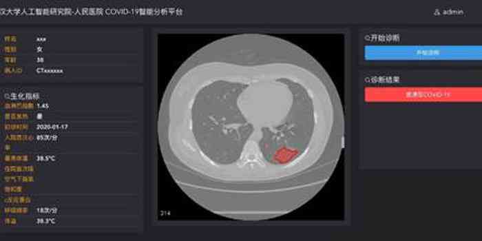 ct报告上ai是im，ais，iac可能性