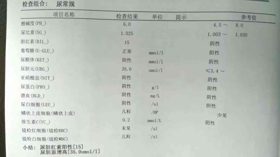 体检报告array：解读含义、出报告时间、性心律说明及三项指标查询方法